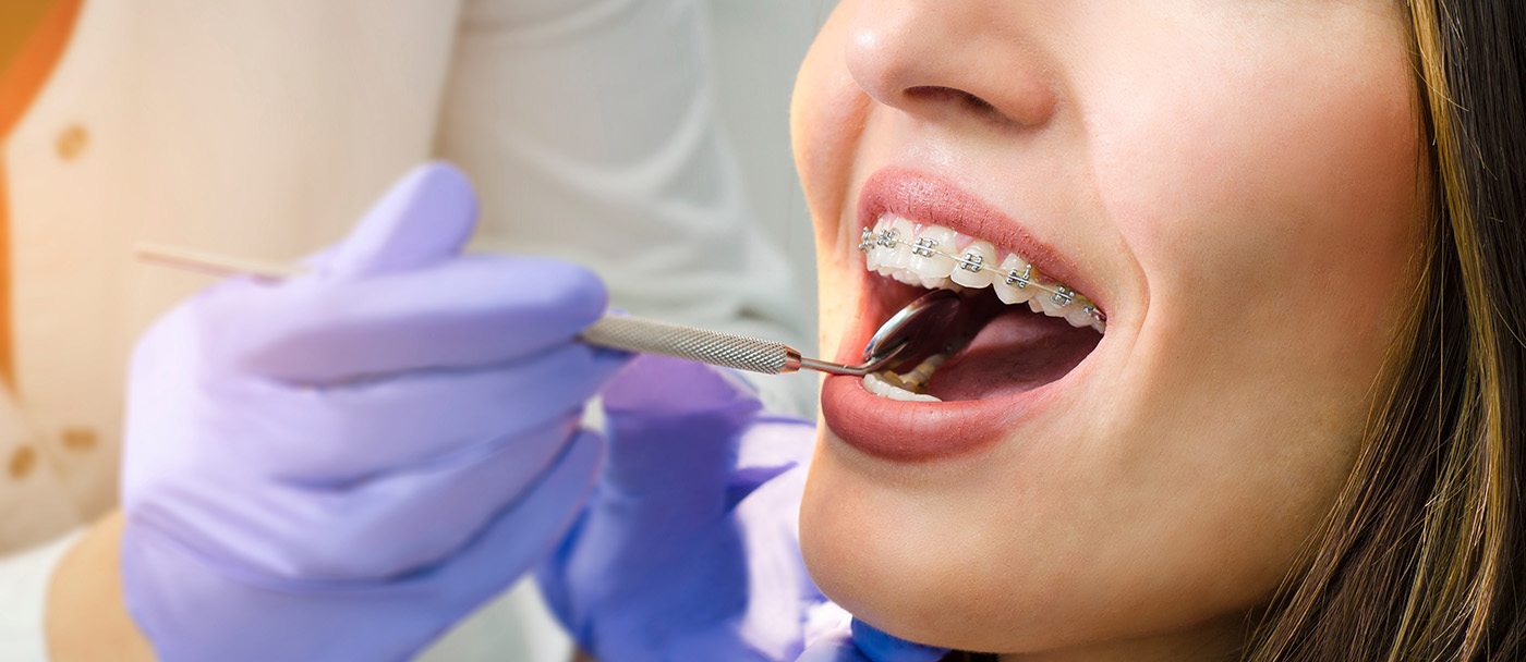 Woman having her teeth checked while wearing traditional braces in Danville