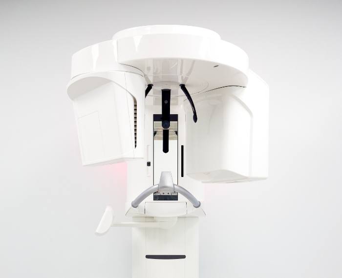 3 D C T cone beam digital x ray scanner