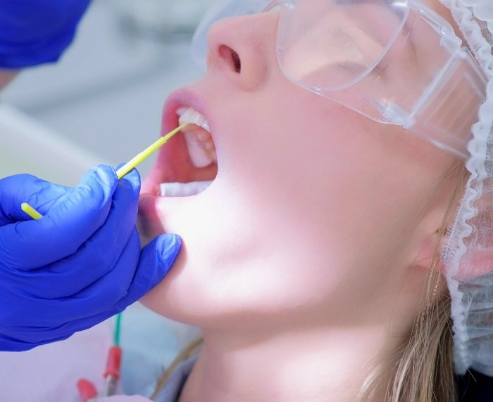 Dental patient receiving fluoride treatment