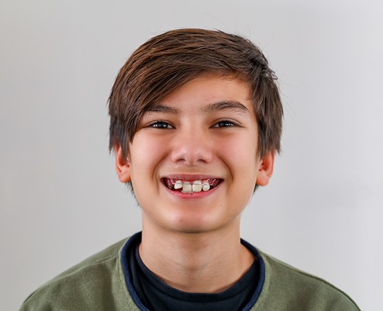a young boy wearing a retainer and smiling